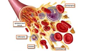 Кровь человека. Что вы знаете о заболеваниях крови?