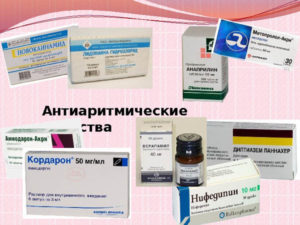 Антиаритмические препараты