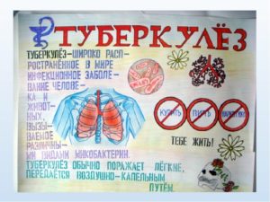 Туберкулез: причины, симптомы, лечение и последствия