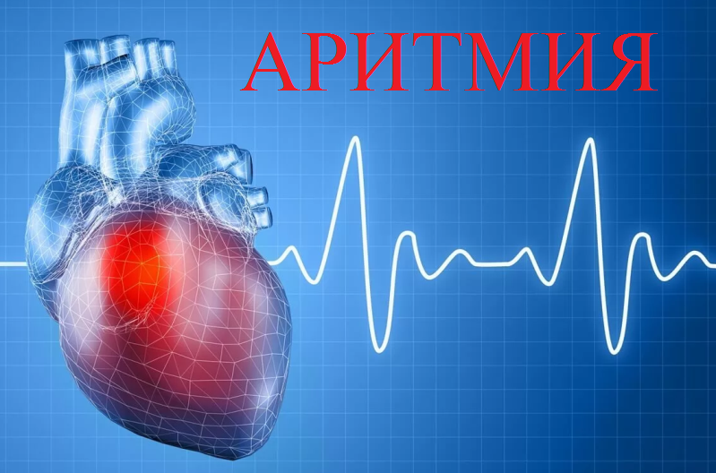 Аритмия : причины, симптомы, диагностика и лечение